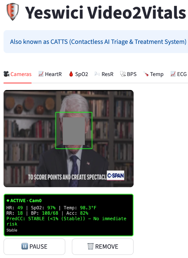 Video2Vitals UI Interface